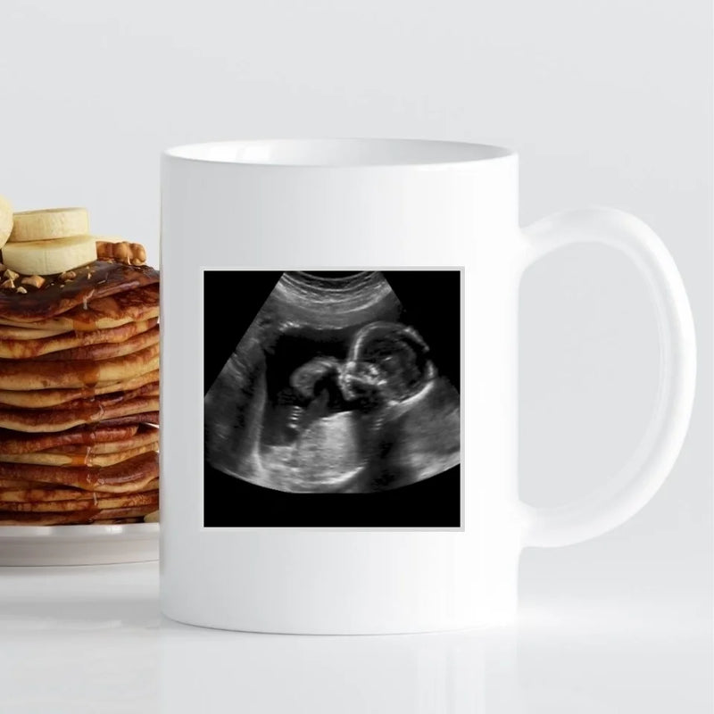 Tasse - Ultraschall-Bild Oma - personalisierbar