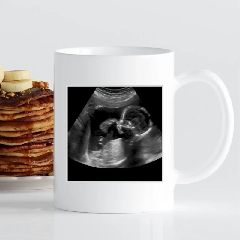 Tasse - Ultraschall-Bild Mama - personalisierbar